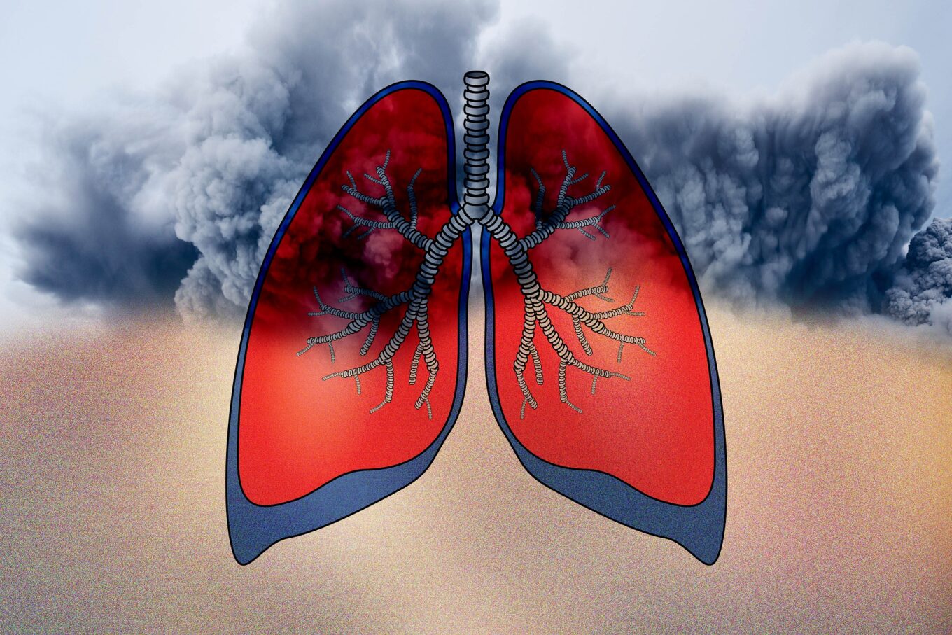 Wood Smoke Allergies: Impact on Breathing